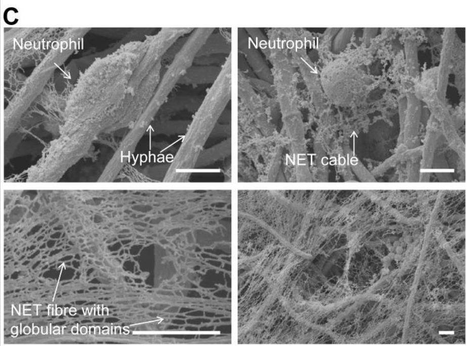 Нейтрофилы сформировали NET после 3 часов инкубации с аспергиллом (гриб)