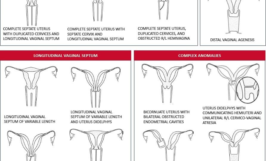 Аномалии развития половых органов у женщин