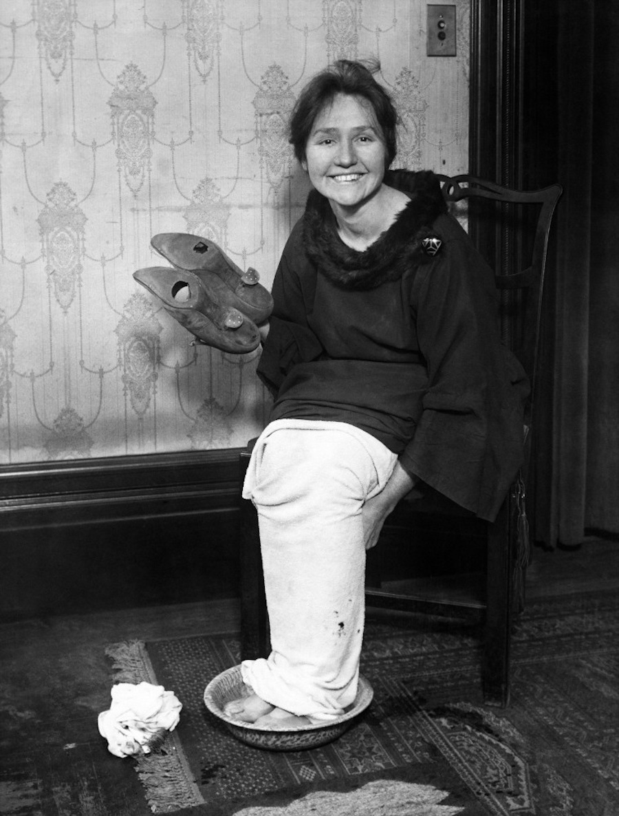 Алма Каммингс восстанавливается после танцевального марафона