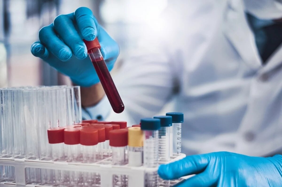    Повышение уровня pTau217 в крови может хорошо предсказывать быстрое развитие симптомов болезни Альцгеймера.