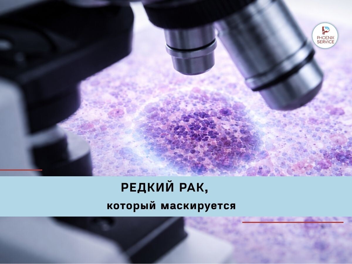Точная диагностика редких опухолей требует микроскопического исследования и специальных маркеров.