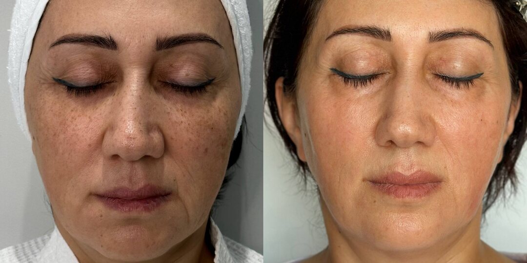 Поделимся кейсом пациентки