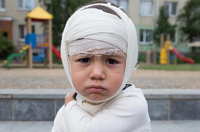 За разбитую голову детский сад в Петропавловске выплатит ребенку компенсацию