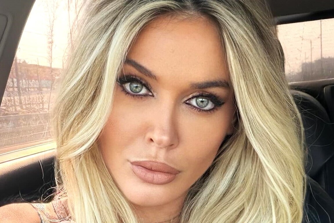     «Я сделала манипуляцию. Это катастрофа»: Таня Терешина рассказала о неудачной процедуре у косметолога