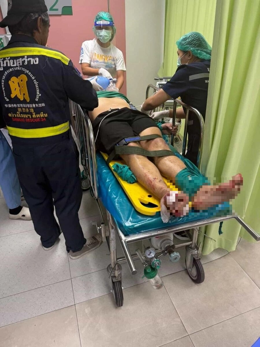    Александр Пожидаев после ДТП. Фото: Соцсети