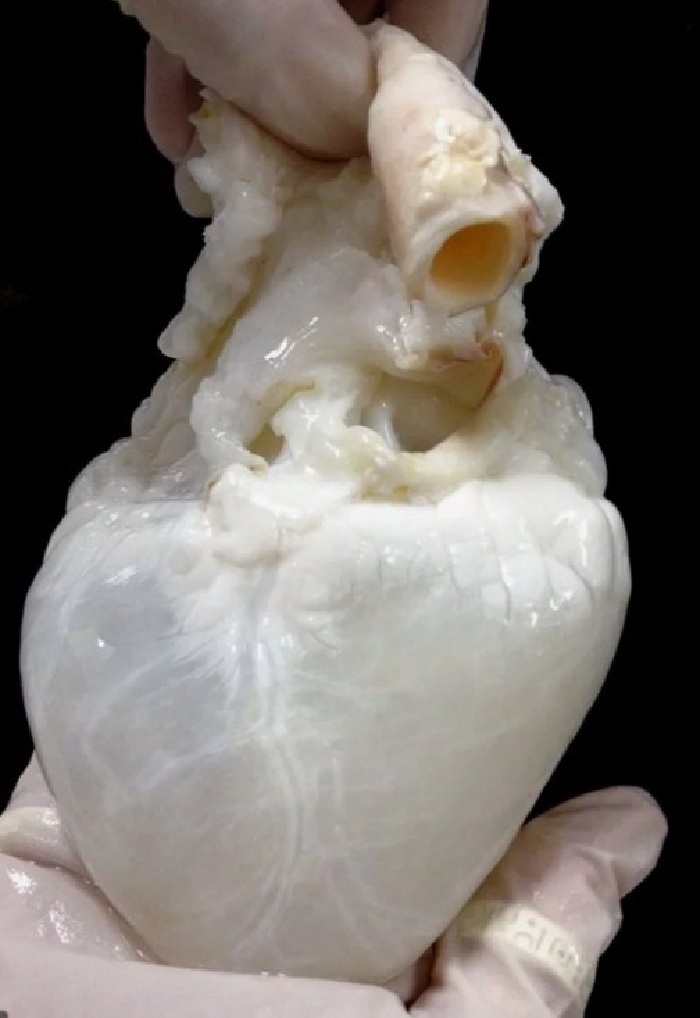 Сердце-призрак: орган без клеток.