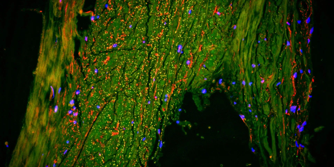 Учёные обнаружили в мозге человека скрытую «сточную канаву»