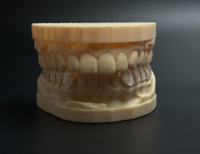 Релаксационная каппа