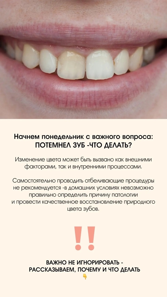 Потемнел зуб -это не всегда просто налёт
Причины могут быть глубже: травма, кариес или проблемы с нервом
Важно не откладывать -приходите на диагностику!