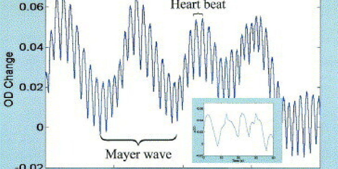ВОЛНЫ МАЙЕРА