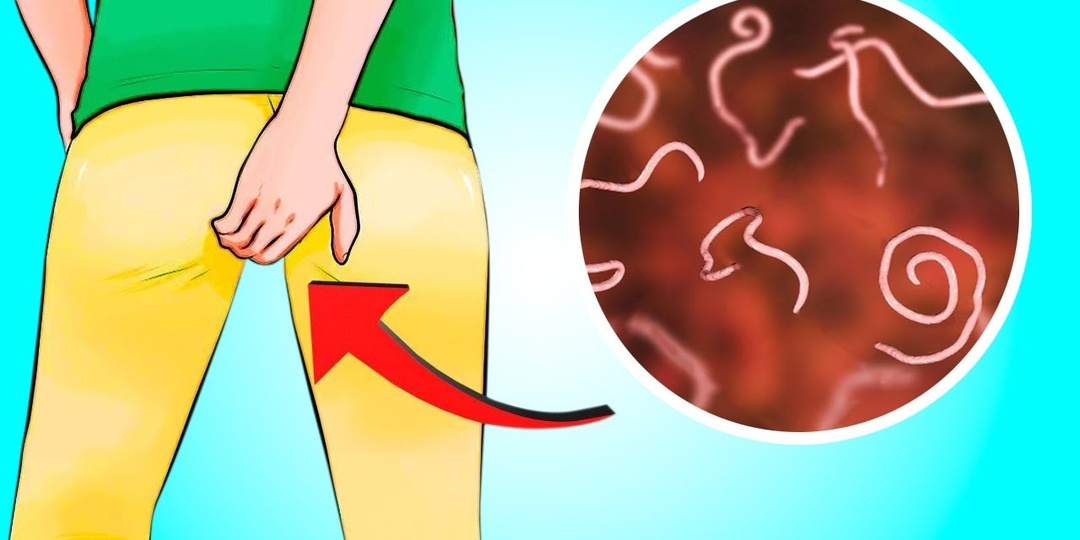 ГЛИСТЫ и другие ПАРАЗИТЫ: как узнать ГДЕ ОНИ + Что делать