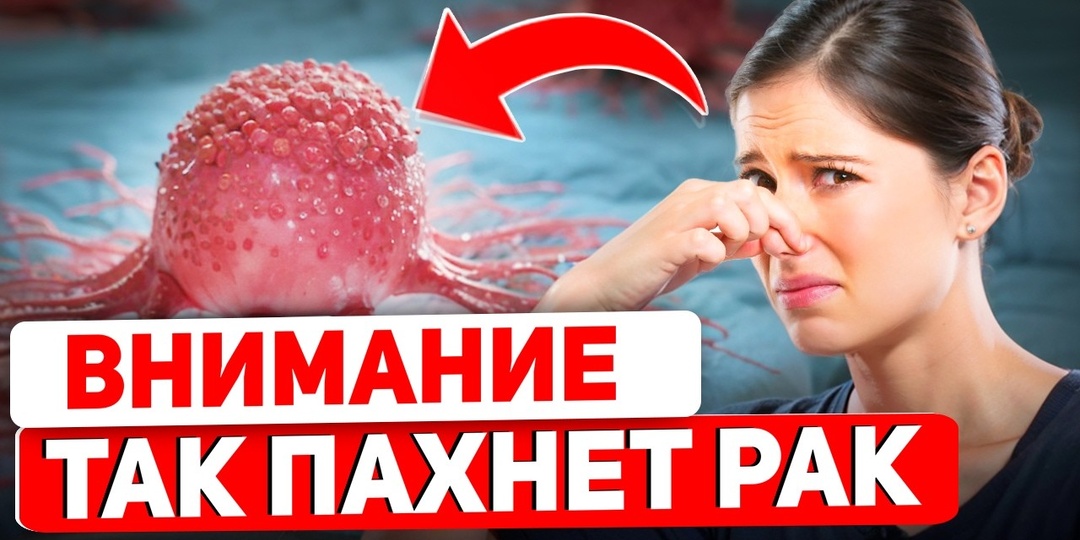 Симптомы Рака, Которые Появляются Тихо И Без Боли