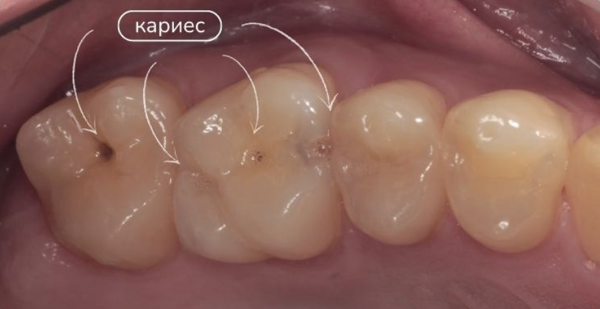 Ситуация "до" 