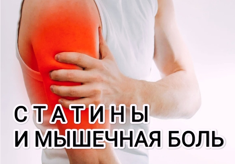 Статины и мышечная боль