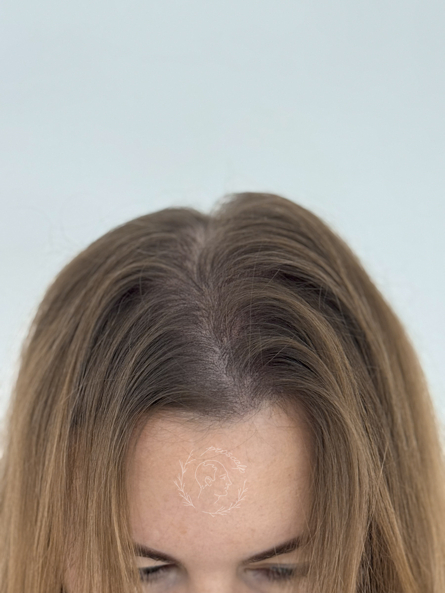 Результат процедуры визуального загущения. Кожа больше не «светится», волосы выглядят объемными.