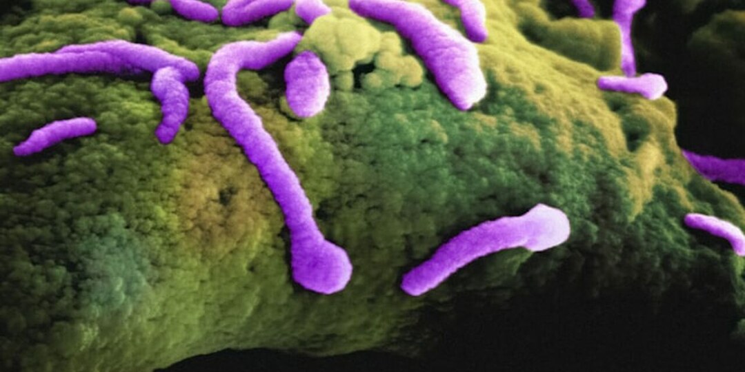 В доколумбовой мумии обнаружена бактерия, вызывающая скарлатину: исследование