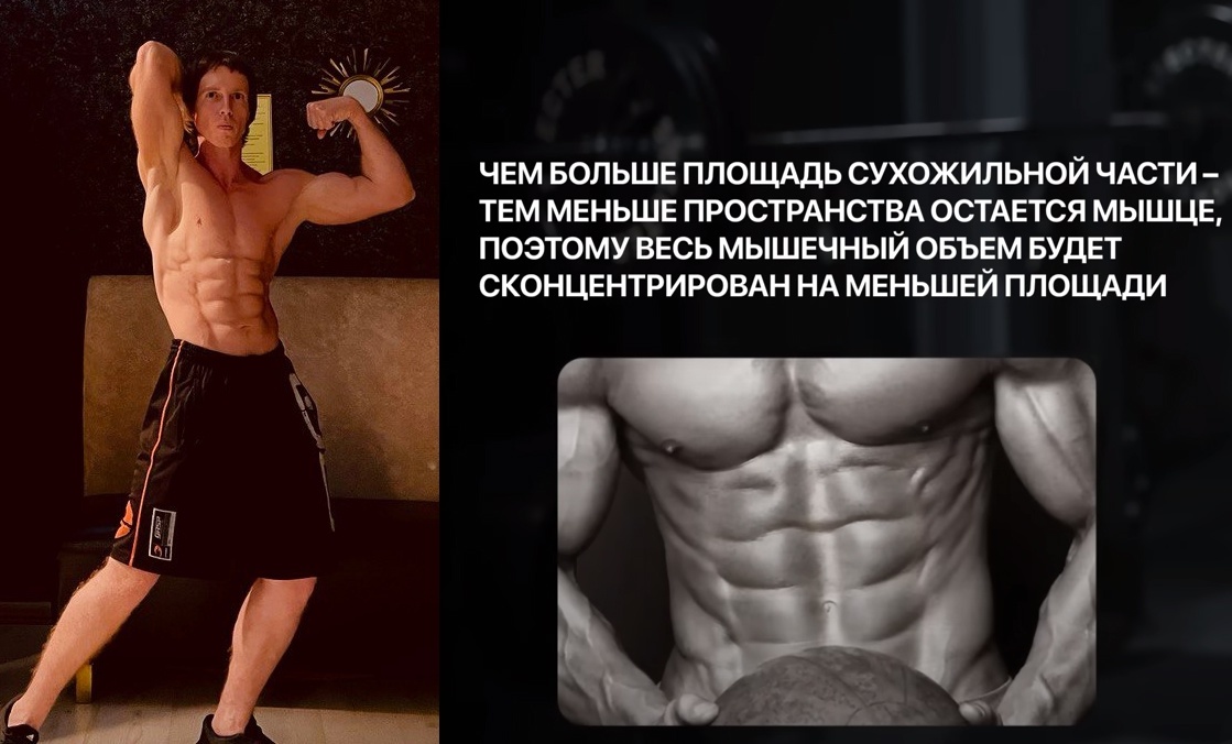 Прямая мышца живота