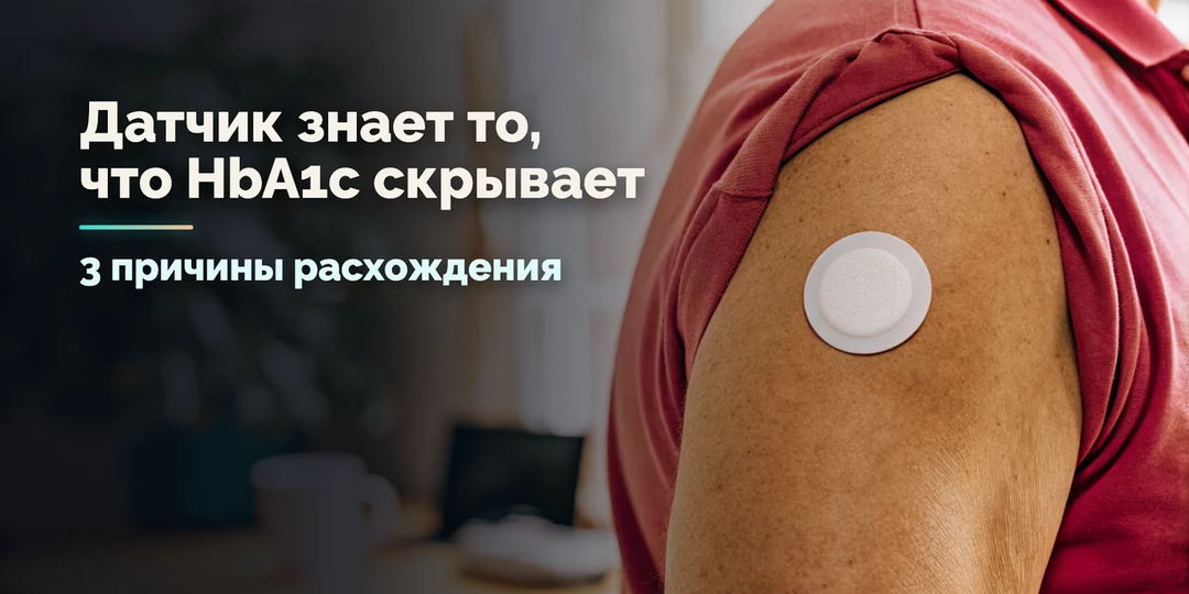 HbA1c врёт на 0,5%: 3 причины расхождения с CGM