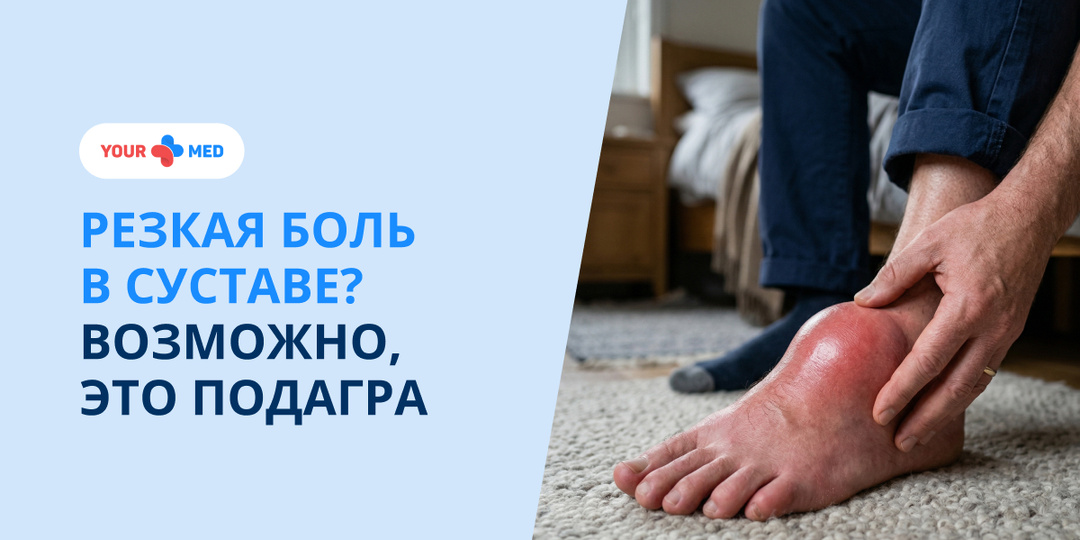 Подагра: почему суставы болят внезапно и что делать