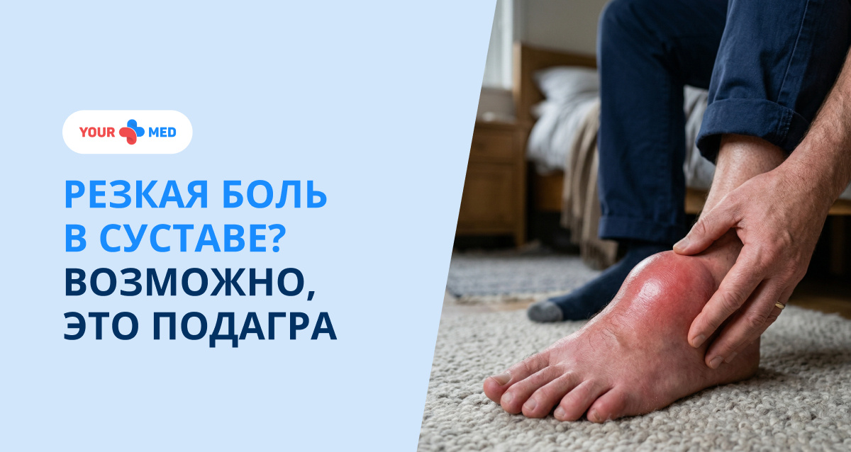Острая боль в суставе, отёк и покраснение — частые признаки подагры. Важно вовремя поставить диагноз и начать лечение.