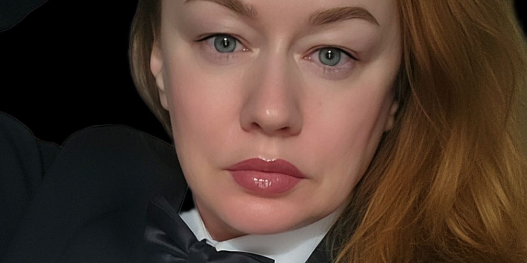 Сухие, бледные, с мигрировавшим пигментом! Лучший позор в моей жизни случился