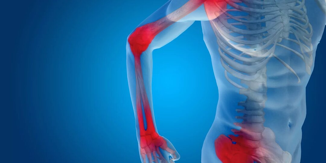 Почему болят мышцы, кости и суставы и какие болезни за этим стоят