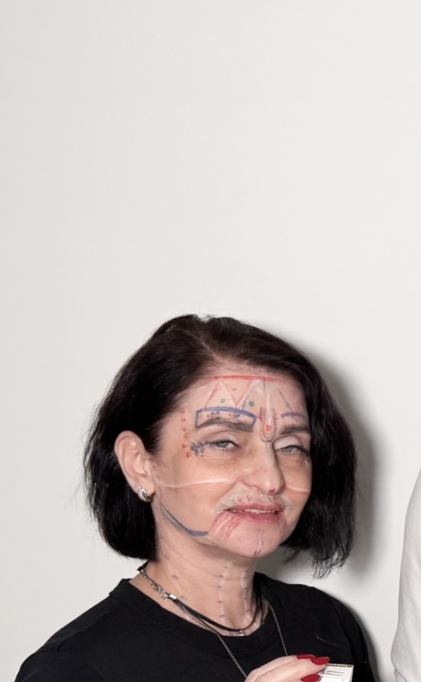 Я Аватар - разметка перед процедурой . 