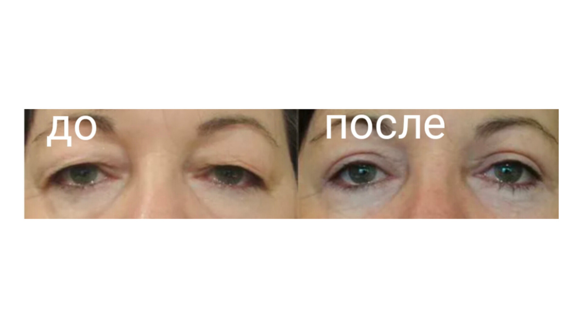 Изображение из Яндекс картинки 