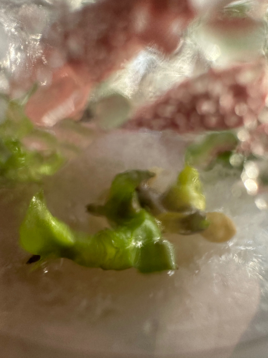 Сиамские близнецы 