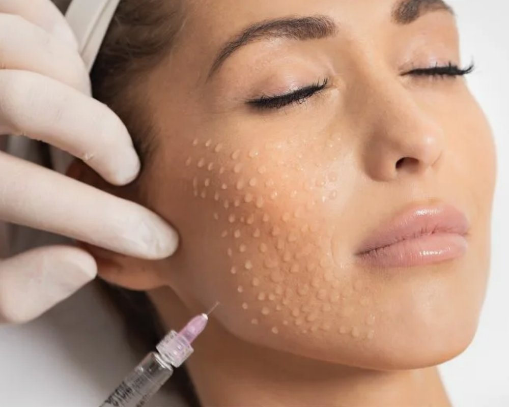 Линейка Revi — это не один препарат, а четыре разные формулы: врач выбирает ту, что подходит конкретной коже, а не назначает «биоревитализацию вообще».