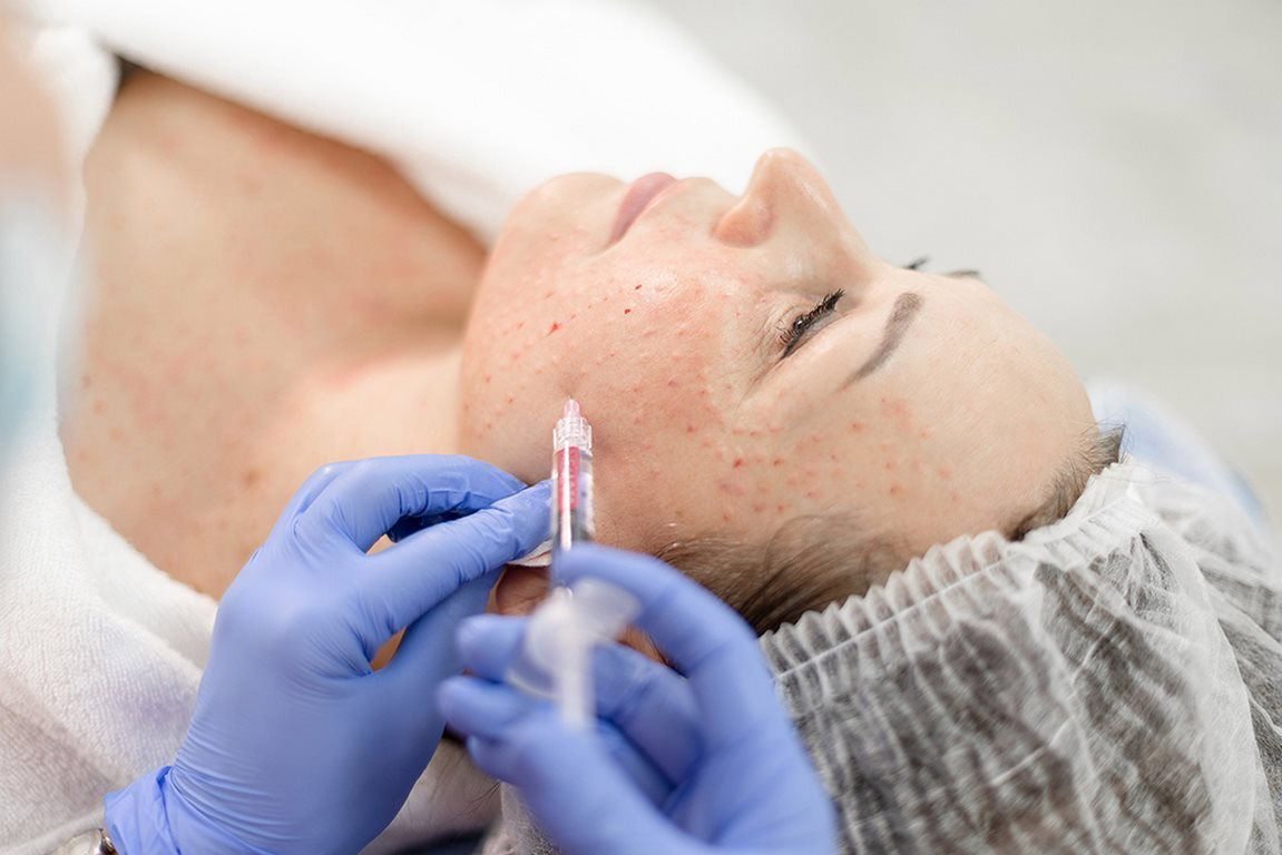 Revi Strong — препарат нового поколения, который работает не только на увлажнение: гиалуроновая кислота, пептиды и антиоксиданты дают выраженный результат для зрелой кожи без агрессивного воздействия.