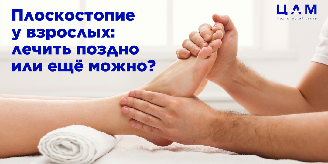 Плоскостопие у взрослых: лечить поздно или ещё можно?