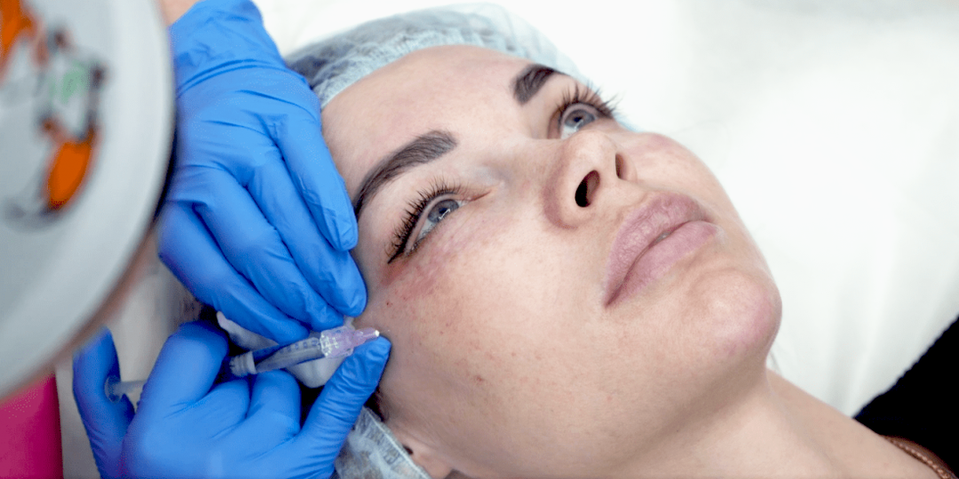 Биоревитализация Revi Eye: как работать с зоной вокруг глаз без риска «переделанного» взгляда