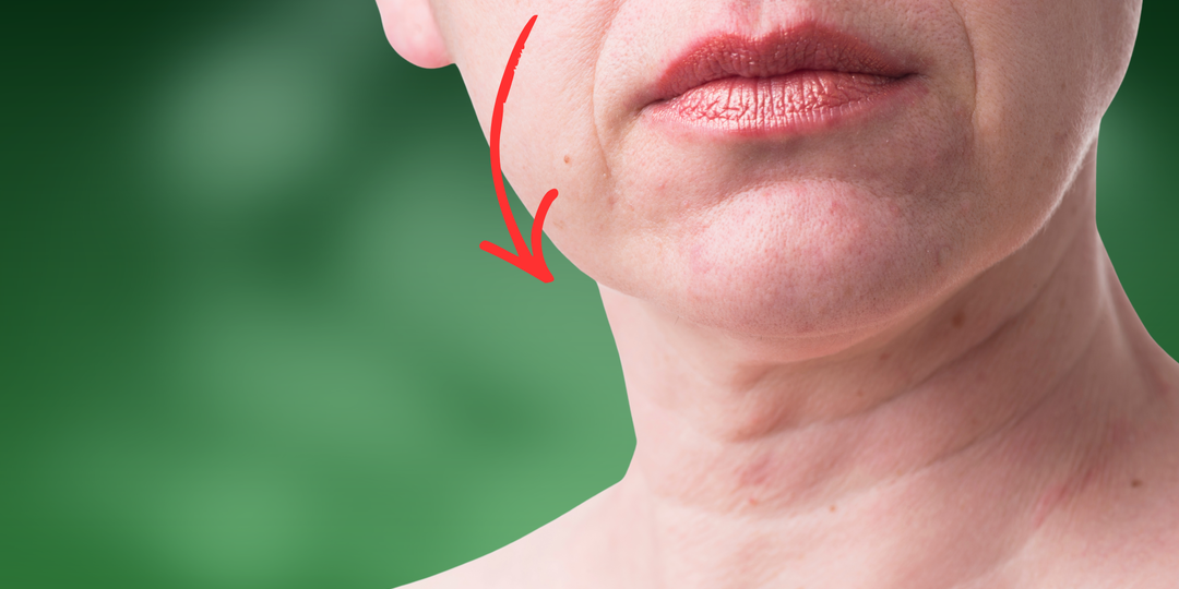 Лицо ПЛЫВЕТ вниз? Пройдите тест пластического хирурга и узнайте, что можно сделать с этой проблемой