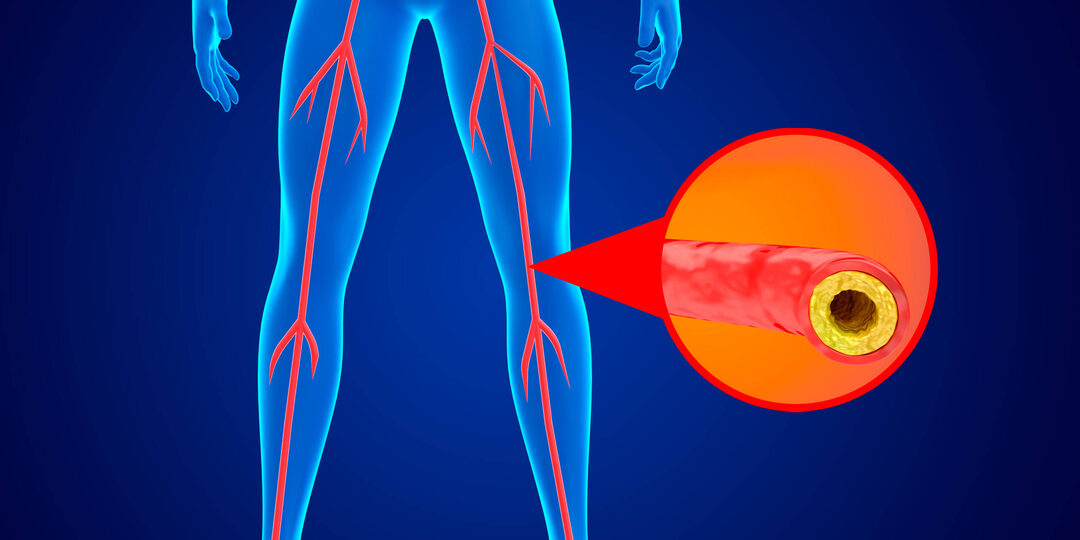 Симптомы Сосудов, Которые Появляются Ночью