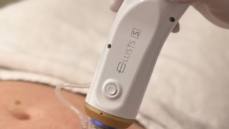 Готовим тело к лету