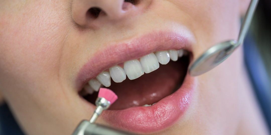 Зубная эмаль — как стекло: что разрушает её быстрее всего и можно ли обратить процесс вспять