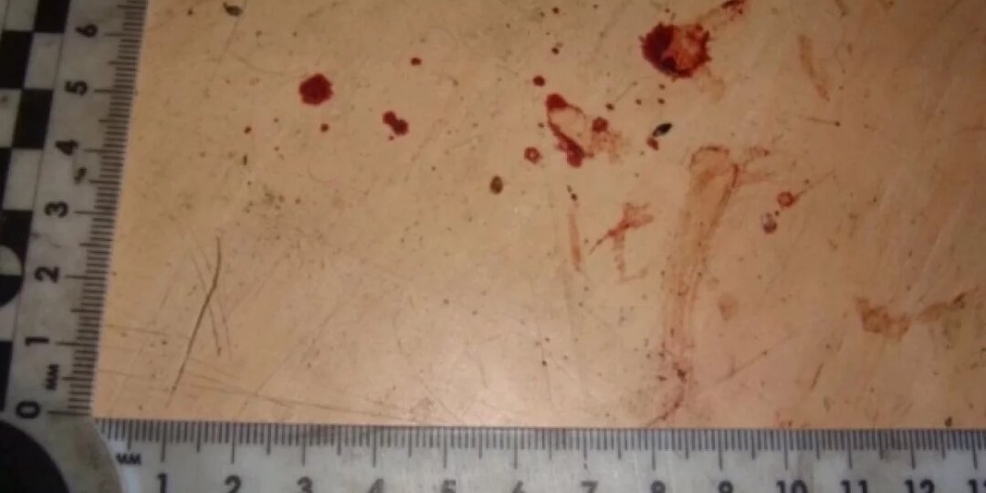 Калужанин ударил ножом в шею подростка за шумное поведение во дворе