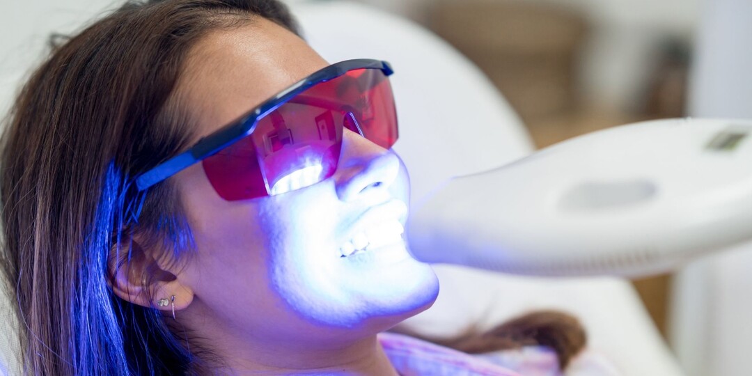 Правда об отбеливании зубов: насколько это безопасно и эффективно