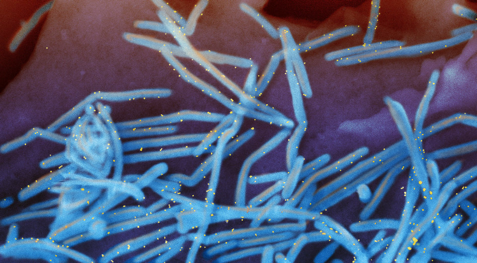   National Institute of Allergy and Infectious Diseases, NIH / Flickr / CC BY-NC 2.0