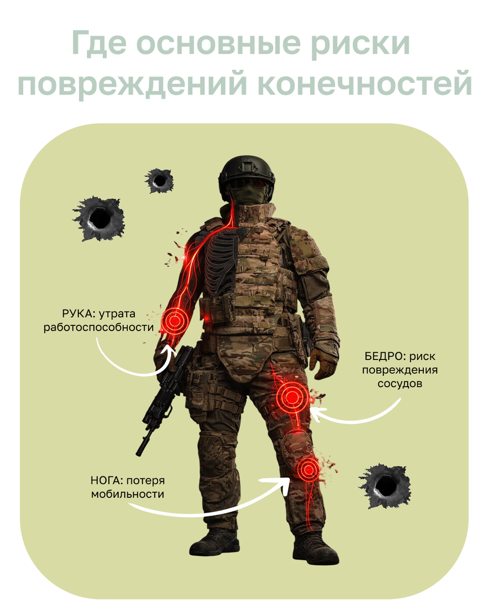 Повреждения конечностей