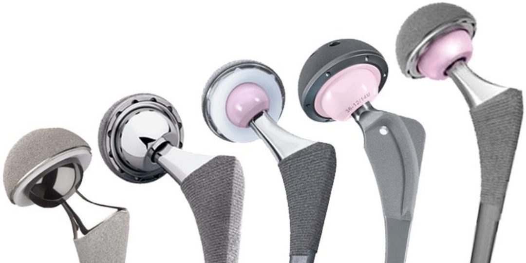 СКОЛЬКО «ЖИВЁТ» ЭНДОПРОТЕЗ