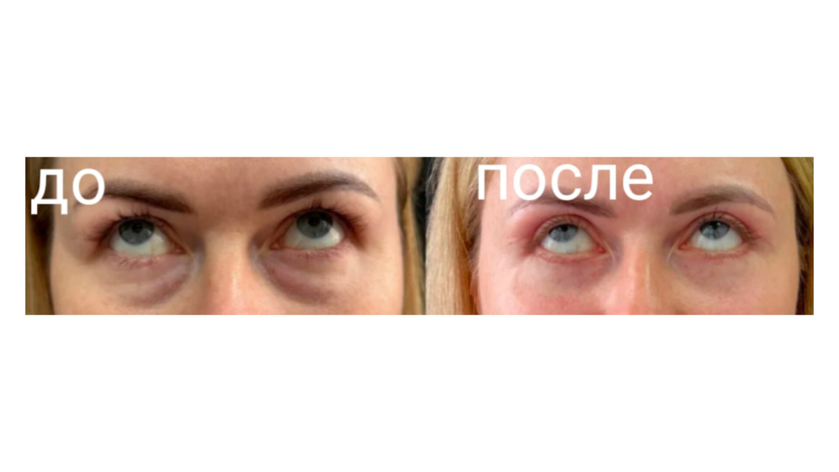 Изображение из Яндекс картинки 
