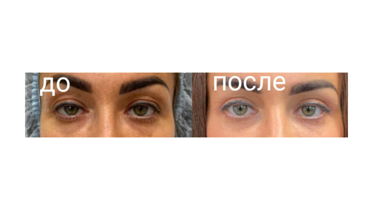 Изображение из Яндекс картинки 