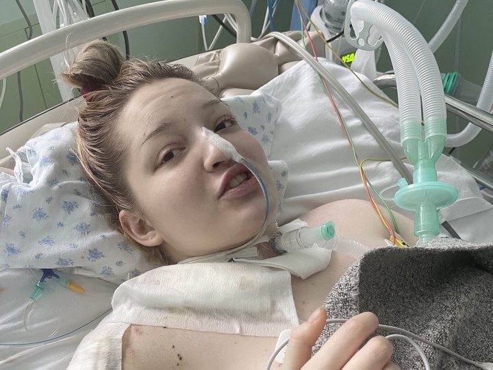 ПОСЛЕ АВАРИИ ДВИГАЛИСЬ ТОЛЬКО ГЛАЗА