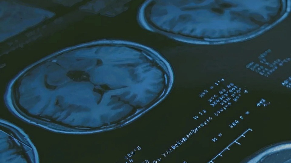 ИИ проанализировал 40 тысяч медицинских снимков пациентов из Тверской области