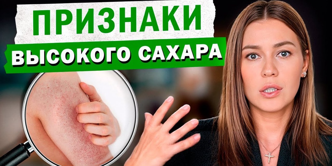 Симптомы Повышенного Сахара В Крови У Женщин После 50: 7 Признаков