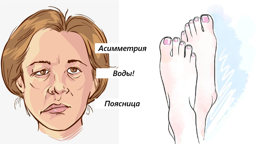 Тело сигналит, а виноваты стопы - какие проявления скажут вам о том, что стопы страдают