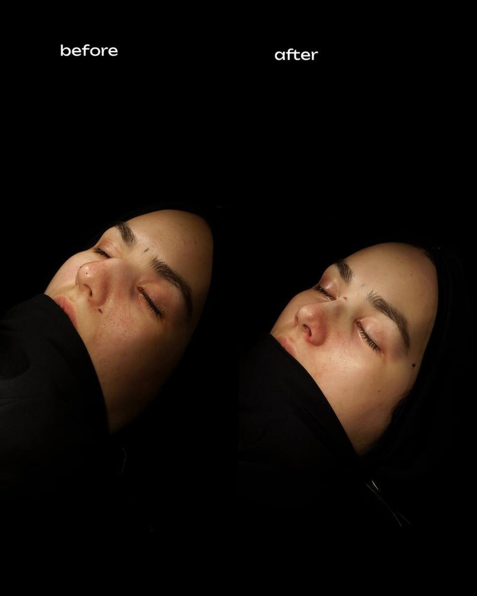 -2