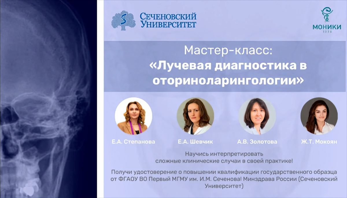 ⏰  Н А П О М И Н А Н И Е